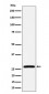 AK2 Antibody